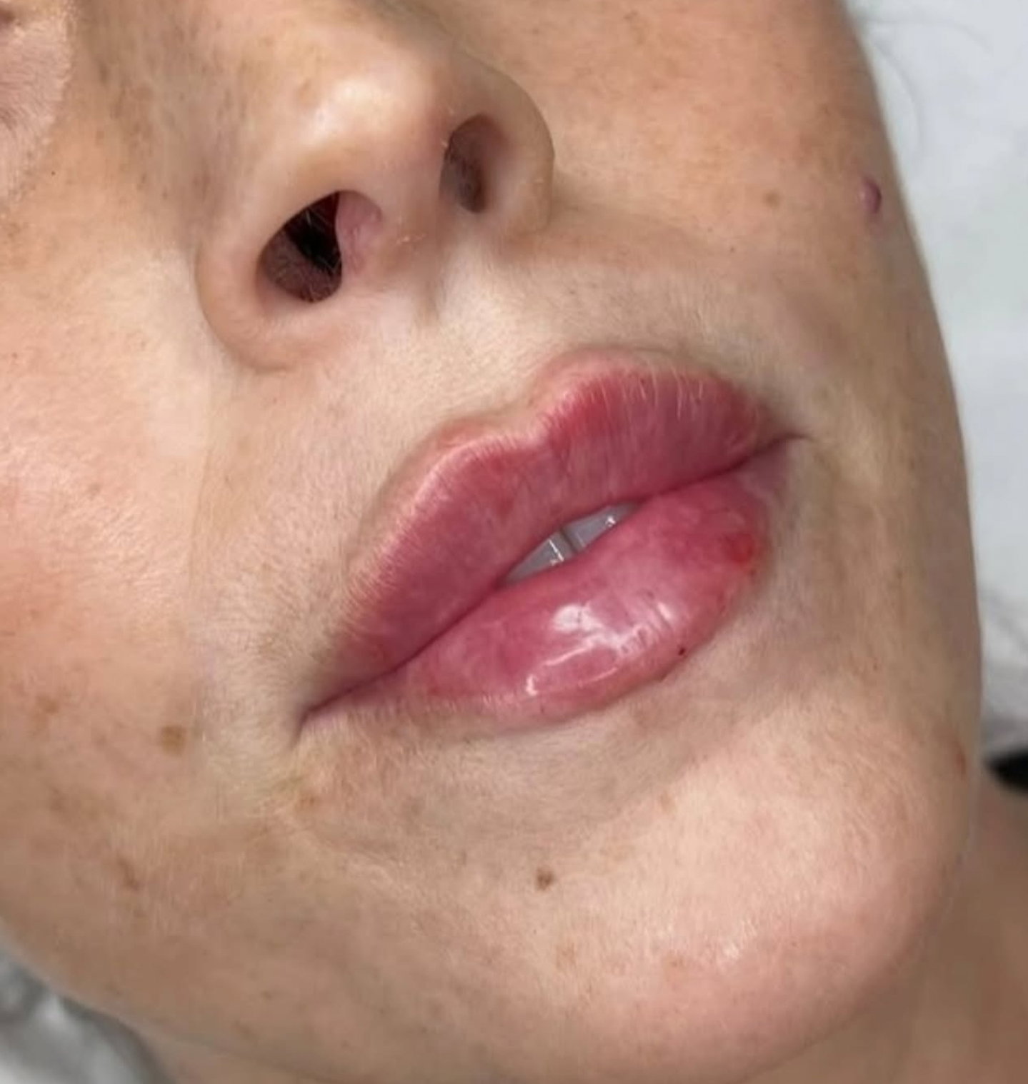 russian lips expert