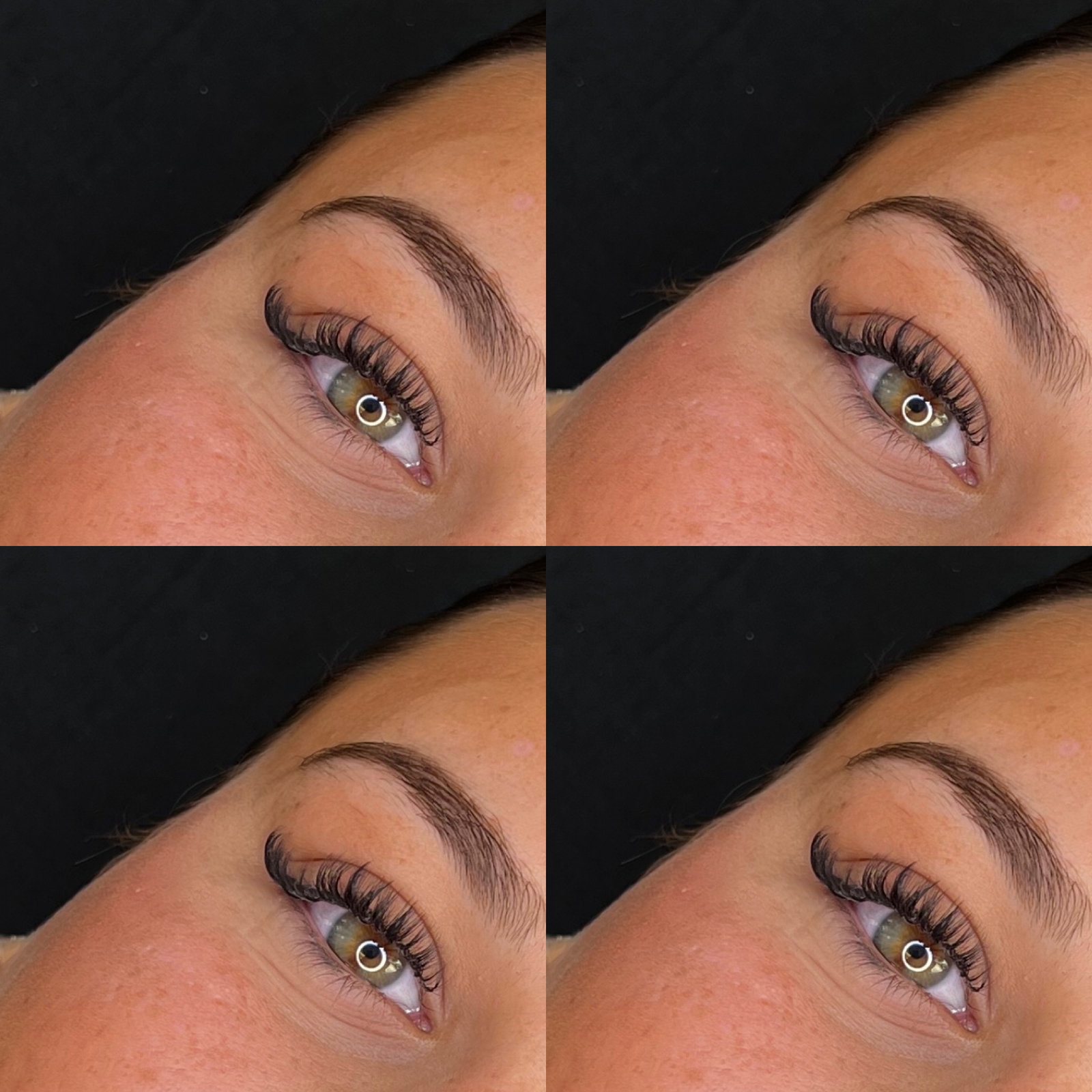 Cils311