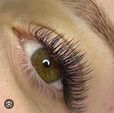 cassesthetique