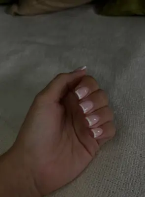 kl_ongles