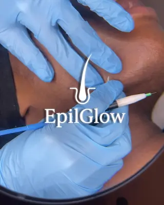 EpilGlow