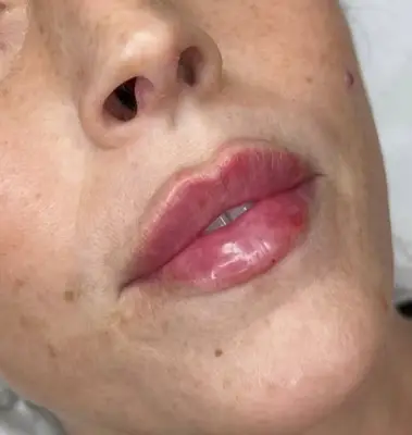 russian lips expert