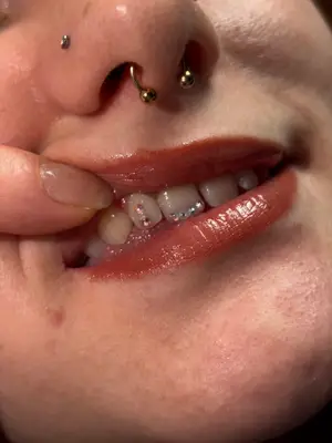 Strasstooth