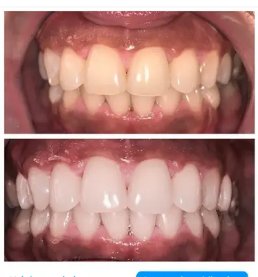 Perfect smile