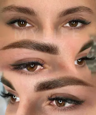 microchading