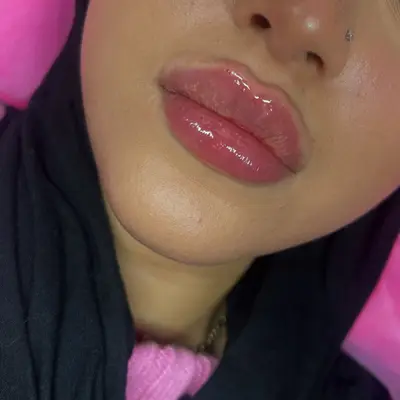 Injections70