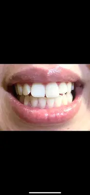 Beautysmilemk