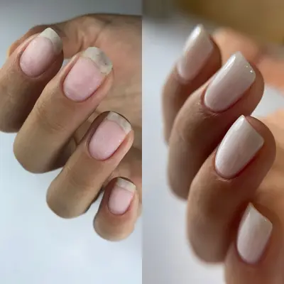 MeelEsthetique