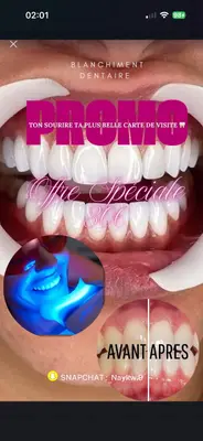 PureSmile77.