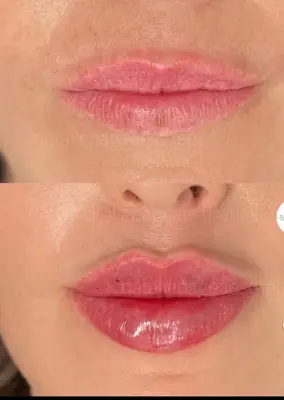 Ksbeauty42