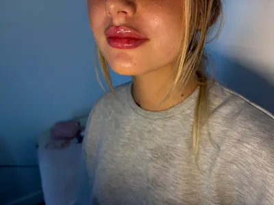 Divainject13