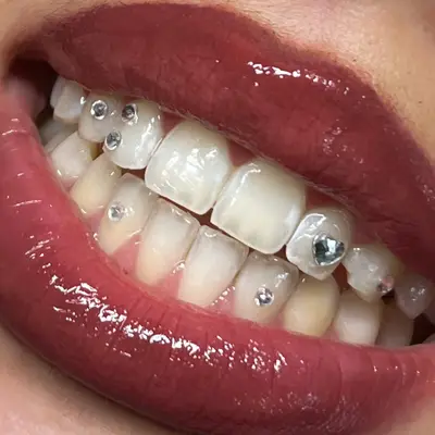 Pimpyourteeth