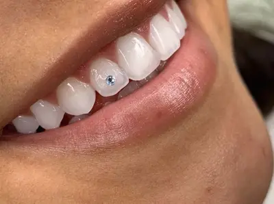 Mysmile